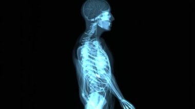 Sırt ağrısı çeken bir adam.