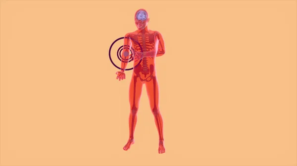 Conceito Anatomia Abstrata Uma Dor Cotovelo — Fotografia de Stock