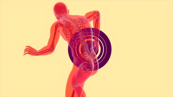 概要腰痛 腎臓の運動設計 — ストック写真