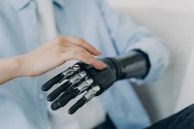 Hands of handicapped girl setting up her bionic arm and pressing buttons. Young european woman with cyber hand at home. Modern robotic bionic prosthesis. Futuristic technology and engineering concept.