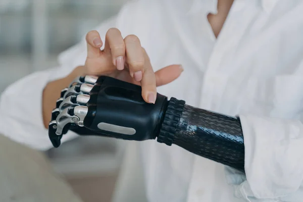 Hands of handicapped girl. Disabled young woman is setting bionic limb. Cyber prosthesis hand has processor chip, software and buttons. European girl has cybernetic carbon hand.