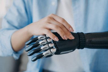 Yakın plan engelli kadın hafif biyonik kol protezini çalıştırıyor. Engelli bir kadın uzuv kaybı üzerine robotik el kullanıyor. Yüksek teknolojili yapay uzuvların reklamı. Tıbbi teknolojiler.