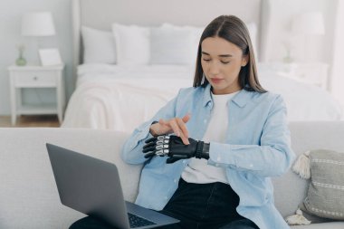 Bilgisayarın önündeki kız biyonik protez hazırlıyor. Genç Avrupalı kadın yapay eli ayarlıyor. Çekici engelli kadın evde çalışıyor. Modern biyonik protez.