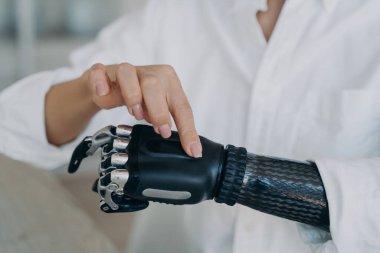 Engelli bir kadın yapay robot el gösteriyor. Biyonik protezinin kabzasını değiştiriyor. Yakın plan. Kinestetik arayüzü olan miyoelektrik protez kol kullanan engelli kişi.