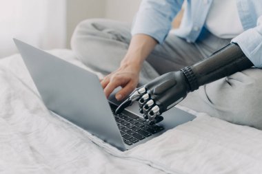 Klavyede dizüstü bilgisayarda çalışan, biyonik protez kol kullanan engelli bir kadın yatakta oturuyor. Özürlü bir kadın yapay robot eliyle tuş takımı kullanıyor. Modern protez reklamcılığı.