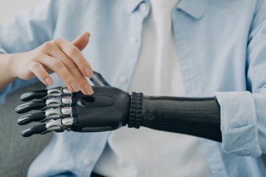 Engelli kız duyusal biyonik el protezini açar, kapat. Özürlü bir kadın yapay robot protez kola dokunuyor. Engelliler ve yüksek teknolojili tıbbi bakım konsepti olanlar..