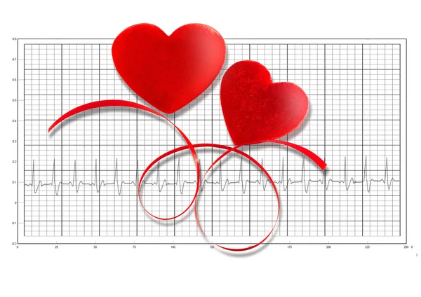 Corazón de papel rojo colgando en el tendedero en el electrocardiograma — Foto de Stock