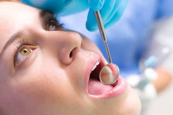 Zubní zrcátko v reflexi zuby v ústech pacienta — Stock fotografie