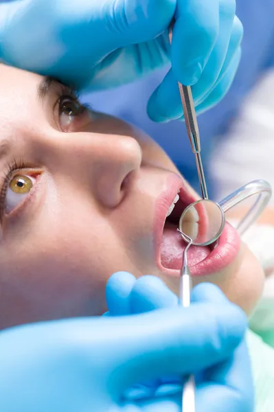 Dentist surgery closeup of woman's open mouth — Stock Photo, Image