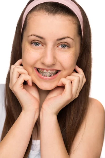 Diş teli ile gülümseyen kız — Stok fotoğraf