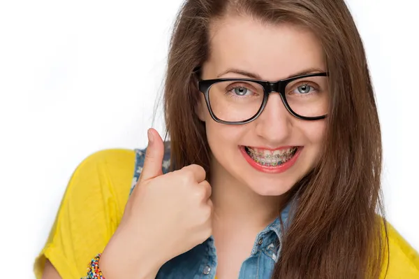 Girl with braces show thumb up — Stock Photo, Image