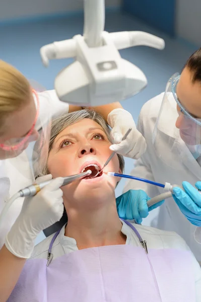 Mujer anciana paciente boca abierta chequeo dental —  Fotos de Stock