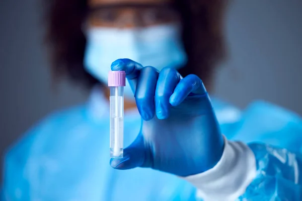 Female Lab Worker Ppe Safety Glasses Face Mask Holding Test — Stock Photo, Image