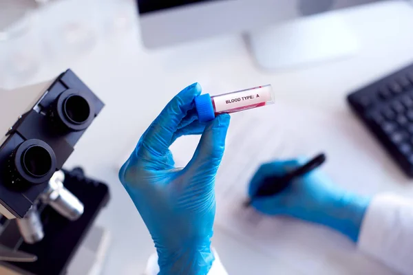 Close Lab Worker Conducting Research Using Microscope Holding Blood Sample — Fotografia de Stock