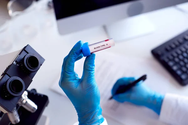 Close Lab Worker Conducting Research Using Microscope Holding Blood Sample — Fotografia de Stock