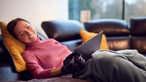 Woman Prosthetic Arm Using Laptop Relaxing Sofa Home — Fotografia de Stock