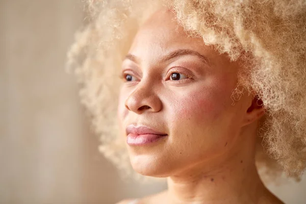 Studio Portret Strzał Pewny Naturalny Albinos Kobieta Bielizna Promocja Ciała — Zdjęcie stockowe