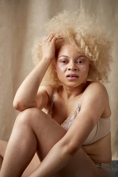 Studio Shot Του Φυσικού Albino Γυναίκα Εσώρουχα Προώθηση Της Θετικότητας — Φωτογραφία Αρχείου