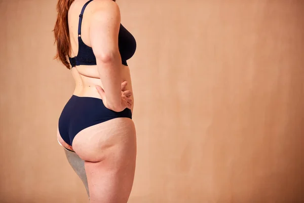 Close Studio Shot Natural Woman Prosthetic Limb Underwear Promoting Body — Stock Photo, Image