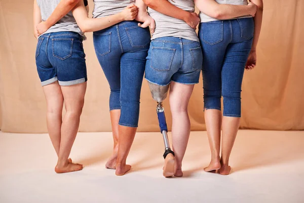 Rückansicht Des Körpers Positive Diverse Lässig Gekleidete Freundinnen Mit Prothetischen — Stockfoto