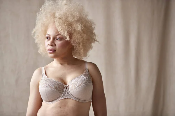 Kendine Güvenen Albino Kadın Çamaşırlı Vücut Pozitifliğinin Stüdyo Portresi — Stok fotoğraf