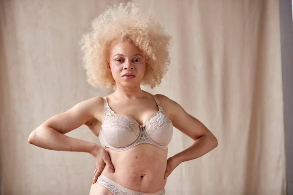 Studio Portrait Shot Confident Natural Albino Woman Underwear Promoting Body — 스톡 사진