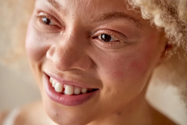 Portrait Studio Prise Vue Une Femme Albinos Naturelle Confiante Sous — Photo