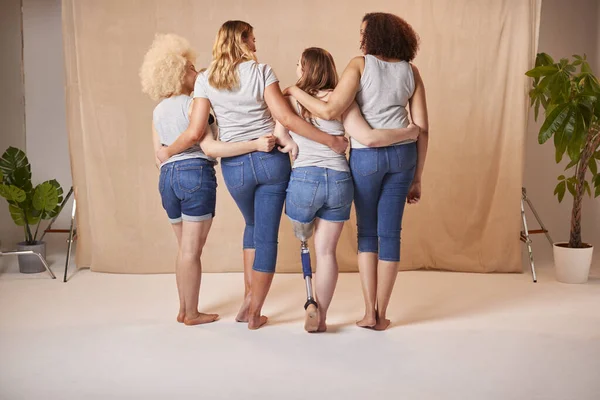 Rückansicht Des Körpers Positive Diverse Lässig Gekleidete Freundinnen Mit Prothetischen — Stockfoto