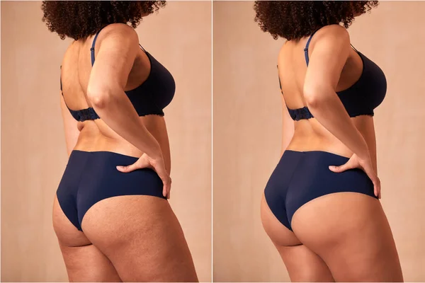 Tiro Compuesto Que Muestra Foto Mujer Ropa Interior Antes Después — Foto de Stock