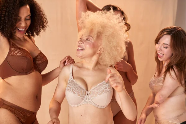 Group Of Diverse Women Friends One With Prosthetic Limb In Underwear Promoting Body Positivity