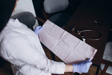 Bir doktorun ellerinde kalp kardiyogramı. Kardiyolog bir elektrokardiyografın tanıklığını inceliyor..