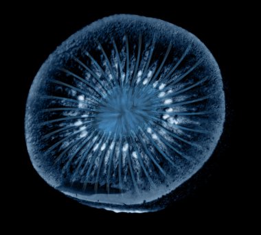 Xray kivi