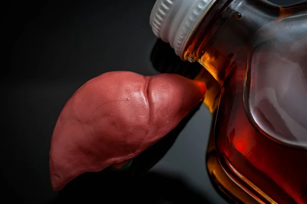 Daño Hepático Alcohólico Concepto Cirrosis Con Hígado Junto Frasco Alcohol —  Fotos de Stock