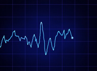 EKG grafiği
