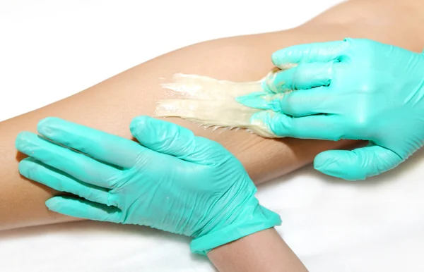 Epilation mit Flüssigzucker an den Beinen — Stockfoto