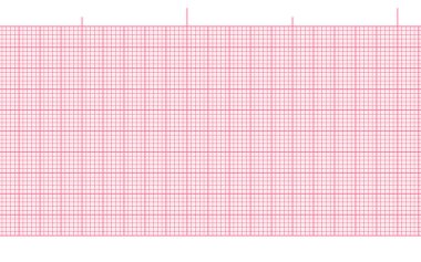 Pink blank ekg paper seamless background for heart beat rate recording