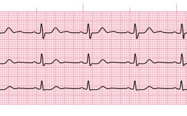 Kalp atışı EKG veya Pembe kağıt üzerinde kusursuz siyah çizgi
