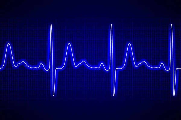 Neon heart beat ecg or ekg seamless black line on blue background Stock Illustration