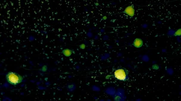Mezcla de colores azul, amarillo y verde en manchas y bolas sobre un fondo negro en movimiento tridimensional, transición. — Vídeo de stock