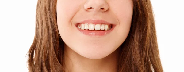 Rindo Adolescente Menina Sorriso Com Grandes Dentes Sobre Fundo Branco — Fotografia de Stock