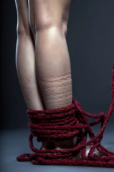 Jambes fines attachées à la corde rouge — Photo