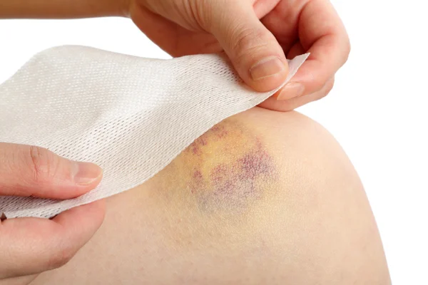 Préparation d'un bandage enveloppé sur le genou blessé — Photo