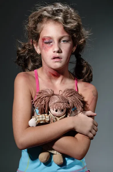 다친된 아이 — 스톡 사진