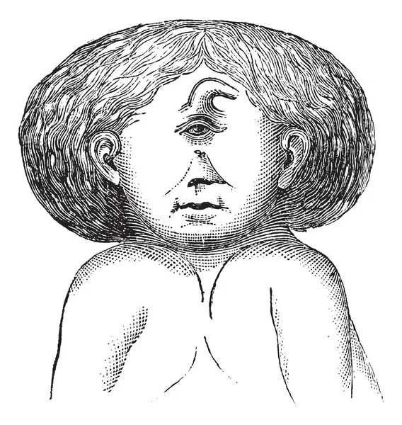 図 629。1 つの頭と 2 体双生児、ビンテージ engrav — ストックベクタ