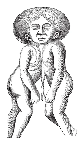 Fig. 628. Una cabeza y dos cuerpos unidos gemelos, engra vintage — Vector de stock