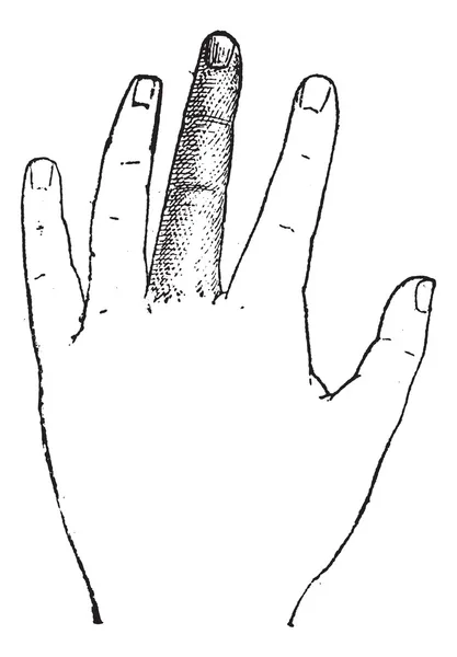 Ανθρώπινη μεσαίο δάχτυλο, vintage Χαρακτική — Διανυσματικό Αρχείο