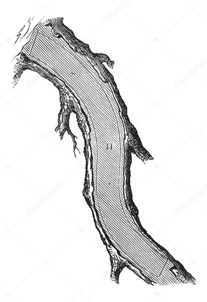 How a Tree is Made into Lumber - Back Knee, vintage engraving