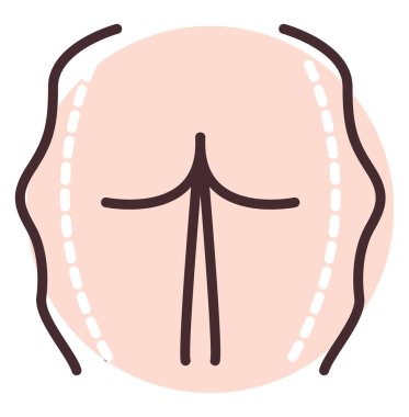 Butt slimming surgery, illustration, vector on white background.