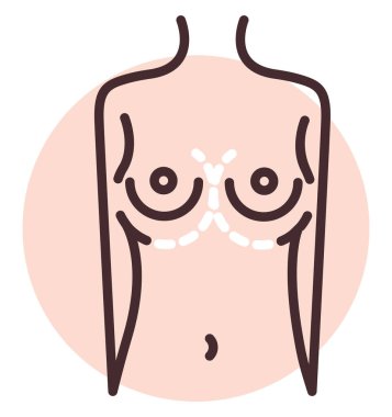 Göğüs ameliyatı, illüstrasyon, beyaz arkaplan vektörü.