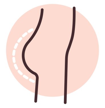 Gluteoplasti ameliyatı, illüstrasyon, beyaz arka plan vektörü.